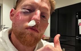 Ben Stokes Breaks